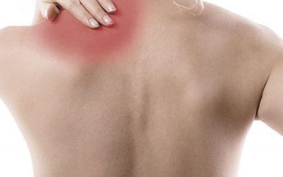 ¿Por qué duele tanto la espalda?